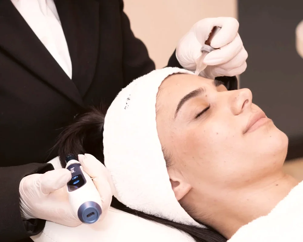 Dermapen bij Zina Beauty