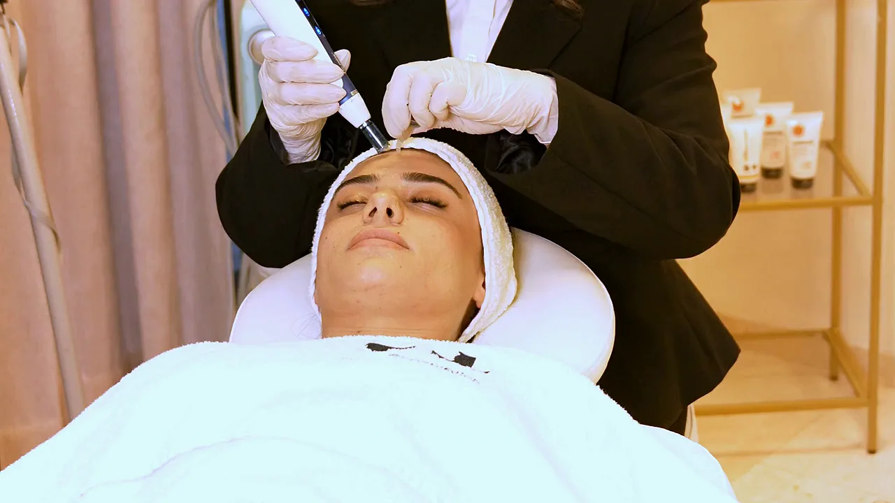 Dermapen bij Zina Beauty